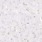 Immunohistochemical staining of human cerebral cortex shows no positivity in neuropil as expected.