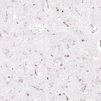 Immunohistochemical staining of human cerebral cortex shows no positivity in neuropil as expected.