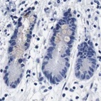 Immunohistochemical staining of human colon using Anti-ATP6V0A4 antibody HPA018029.