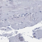 Immunohistochemical staining of human skeletal muscle shows no positivity in myocytes as expected.