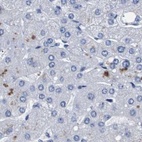 Immunohistochemical staining of human liver using Anti-ATP6V0A4 antibody HPA018029.