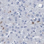 Immunohistochemical staining of human liver using Anti-ATP6V0A4 antibody HPA018029.