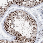 Immunohistochemical staining of human testis shows strong nuclear positivity in cells in seminiferous ducts.