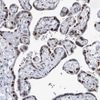 Immunohistochemical staining of human placenta shows strong nuclear positivity in trophoblastic cells.