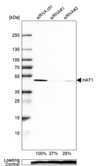 Western blot analysis in Caco-2 cells transfected with control siRNA, target specific siRNA probe #1 and #2, using Anti-HAT1 antibody. Remaining relative intensity is presented. Loading control: Anti-PPIB.