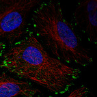 Immunofluorescence staining in HeLa cell line with Anti-ZYX monoclonal antibody, showing distinct focal adhesion staining in green. Microtubule- and nuclear probes are visualized in red and blue respectively (where available).