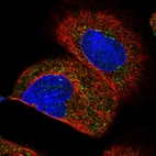 Immunofluorescent staining of human cell line A-431 shows localization to peroxisomes.