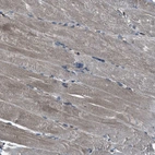 Immunohistochemical staining of human skeletal muscle shows weak cytoplasmic positivity in myocytes.