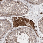 Immunohistochemical staining of human testis shows strong cytoplasmic positivity in Leydig cells.