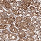 Immunohistochemical staining of human kidney shows strong cytoplasmic positivity in cells in tubules.