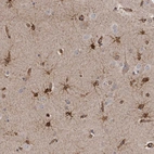 Immunohistochemical staining of human cerebral cortex shows strong cytoplasmic positivity in glial cells.