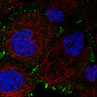 Immunofluorescence staining in A431 cell line with Anti-ZYX monoclonal antibody, showing distinct focal adhesion staining in green. Microtubule- and nuclear probes are visualized in red and blue respectively (where available).