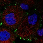Immunofluorescence staining in A431 cell line with Anti-ZYX monoclonal antibody, showing distinct focal adhesion staining in green. Microtubule- and nuclear probes are visualized in red and blue respectively (where available).