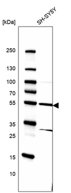 Western blot analysis in human cell line SH-SY5Y.