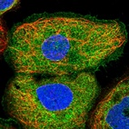 Immunofluorescent staining of human cell line A-431 shows localization to plasma membrane & cytosol.