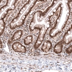 Immunohistochemical staining of human duodenum shows strong nuclear positivity in glandular cells.