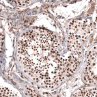 Immunohistochemical staining of human testis shows strong nuclear positivity in cells in seminiferous ducts.