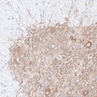 Immunohistochemical staining of mouse spinal cord shows strong cytoplasmic positivity in neuronal cell bodies and processes in the gray matter.