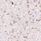 Immunohistochemical staining of human liver shows strong cytoplasmic positivity in bile duct cells.