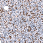 Immunohistochemical staining of human pancreas shows strong cytoplasmic positivity in intercalated ducts.