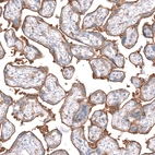 Immunohistochemical staining of human placenta shows strong membranous positivity in trophoblastic cells.