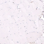 Immunohistochemical staining of human skeletal muscle shows no positivity in myocytes as expected.