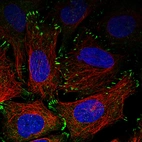 Immunofluorescence staining in U2OS cell line with Anti-ZYX monoclonal antibody, showing distinct focal adhesion staining in green. Microtubule- and nuclear probes are visualized in red and blue respectively (where available).