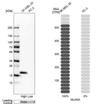 Western blot analysis in human cell lines SK-MEL-30 and PC-3 using Anti-MLANA antibody. Corresponding MLANA RNA-seq data are presented for the same cell lines. Loading control: Anti-GAPDH.