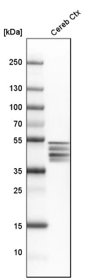 Western blot analysis in human cerebral cortex tissue.