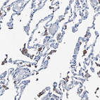 Immunohistochemical staining of human lung shows moderate cytoplasmic positivity in macrophages.