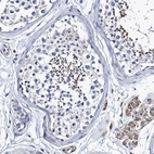 Immunohistochemical staining of human testis shows moderate cytoplasmic positivity in spermatids and leydig cells.