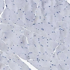 Immunohistochemical staining of human skeletal muscle shows no positivity in myocytes as expected.