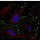 Immunofluorescence staining in U251 cell line with Anti-ZYX monoclonal antibody, showing distinct focal adhesion staining in green. Microtubule- and nuclear probes are visualized in red and blue respectively (where available).