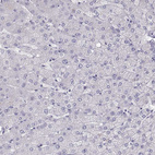 Immunohistochemical staining of human liver shows no positivity in hepatocytes as expected.