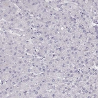 Immunohistochemical staining of human liver shows no positivity in hepatocytes as expected.