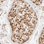Immunohistochemical staining of human testis shows strong nuclear positivity in cells in seminiferous ducts.