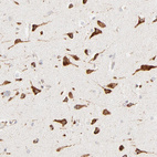 Immunohistochemical staining of human cerebral cortex shows strong cytoplasmic positivity in neurons.