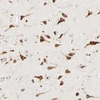 Immunohistochemical staining of human cerebral cortex shows strong cytoplasmic positivity in neurons.