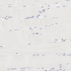 Immunohistochemical staining of human skeletal muscle shows no positivity in myocytes as expected.