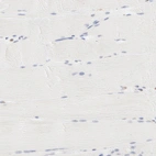 Immunohistochemical staining of human skeletal muscle shows no positivity in myocytes as expected.