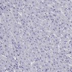 Immunohistochemical staining of human liver shows no positivity in hepatocytes as expected.
