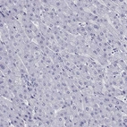 Immunohistochemical staining of human liver shows no positivity in hepatocytes as expected.