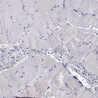 Immunohistochemical staining of human skeletal muscle shows no positivity in myocytes as expected.