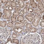 Immunohistochemical staining of human kidney shows moderate cytoplasmic positivity in cells in tubules.