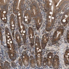 Immunohistochemical staining of human duodenum shows strong cytoplasmic positivity in glandular cells.