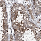 Immunohistochemical staining of human testis shows moderate cytoplasmic positivity in cells in seminiferous ducts.