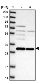 Lane 1: Marker [kDa] 230, 130, 95, 72, 56, 36, 28, 17, 11_br/_Lane 2: Human cell line RT-4_br/_Lane 3: Human cell line U-251MG sp