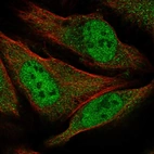 Immunofluorescent staining of human cell line U-2 OS shows localization to nucleoplasm & cytosol.