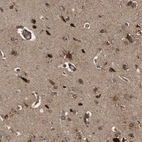 Immunohistochemical staining of human cerebral cortex shows strong cytoplasmic positivity in glial cells.