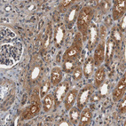 Immunohistochemical staining of human kidney shows moderate cytoplasmic positivity in cells in tubules.